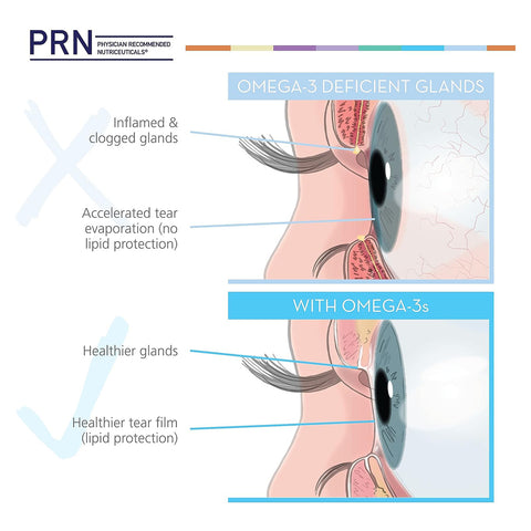 PRN Dry Eye Omega Benefits® Liquid (1.3 and 2 month Sizes)