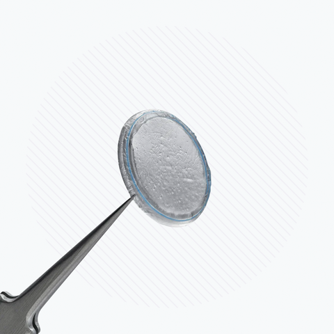 A BioTissue Prokera Amniotic Membrane is gently held by tweezers against a textured white background. The transparent membrane, similar to a corneal bandage, is magnified slightly to highlight its textured surface, emphasizing its regenerative healing properties.