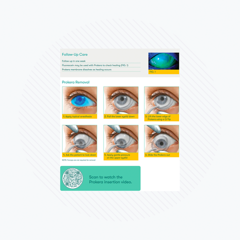 A guide on removing Prokera Amniotic Membranes by BioTissue features close-up images with orange and blue highlights, plus a QR code linking to an insertion video underscoring its regenerative function similar to corneal bandages.