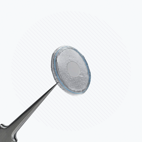 A close-up shows surgical forceps holding a Prokera Amniotic Membrane by BioTissue, partially opaque with a subtle design, serving as a corneal bandage against a white background with faint diagonal lines.