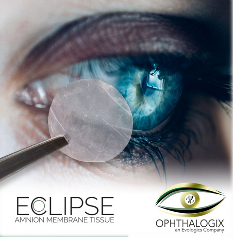 Eclipse Dehydrated Dual Layer Amniotic Membrane by Ophthalogix